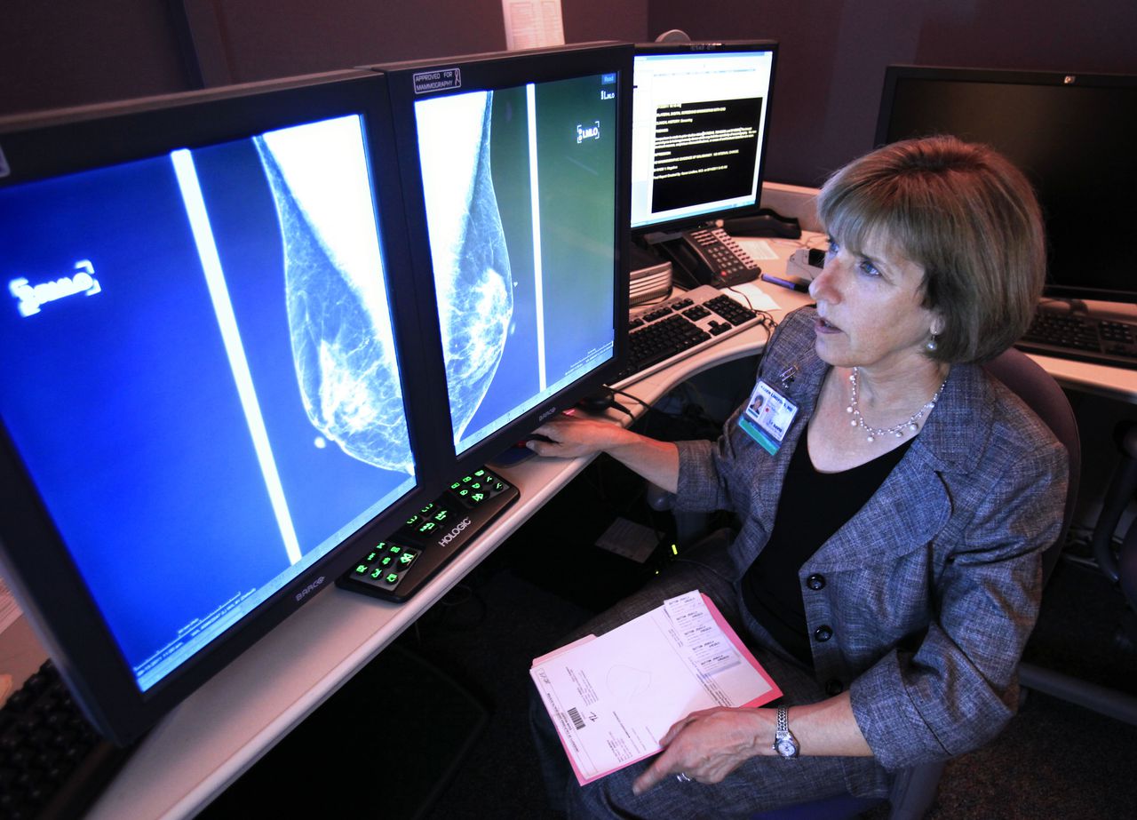 Alabama only state where Medicaid won’t cover some breast cancer screening