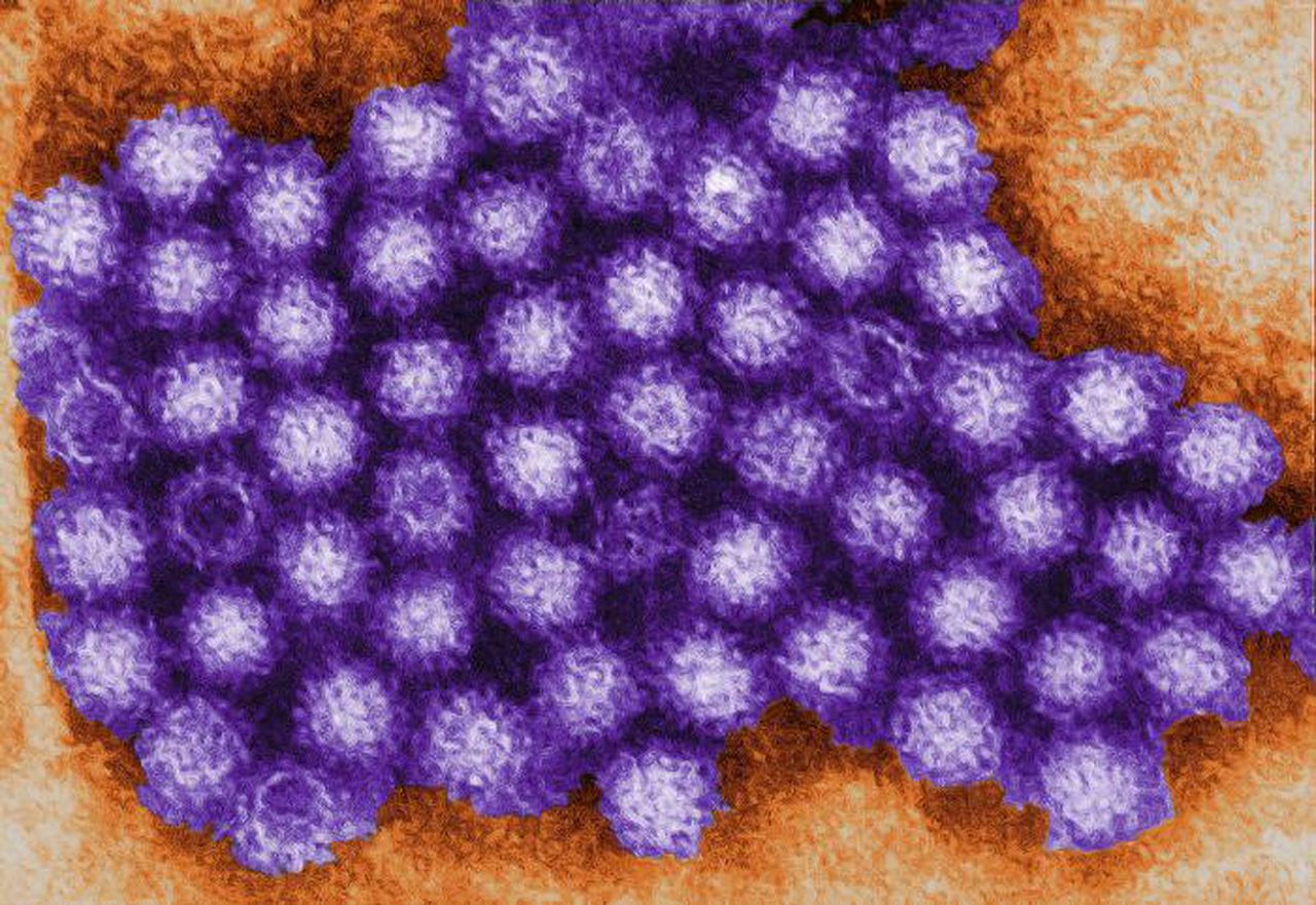 Stomach bug outbreak: Norovirus cases up 30%, CDC warns