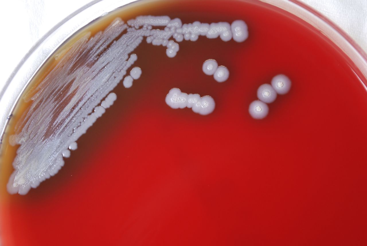 Bacteria causing potentially fatal melioidosis endemic to Gulf Coast, CDC says