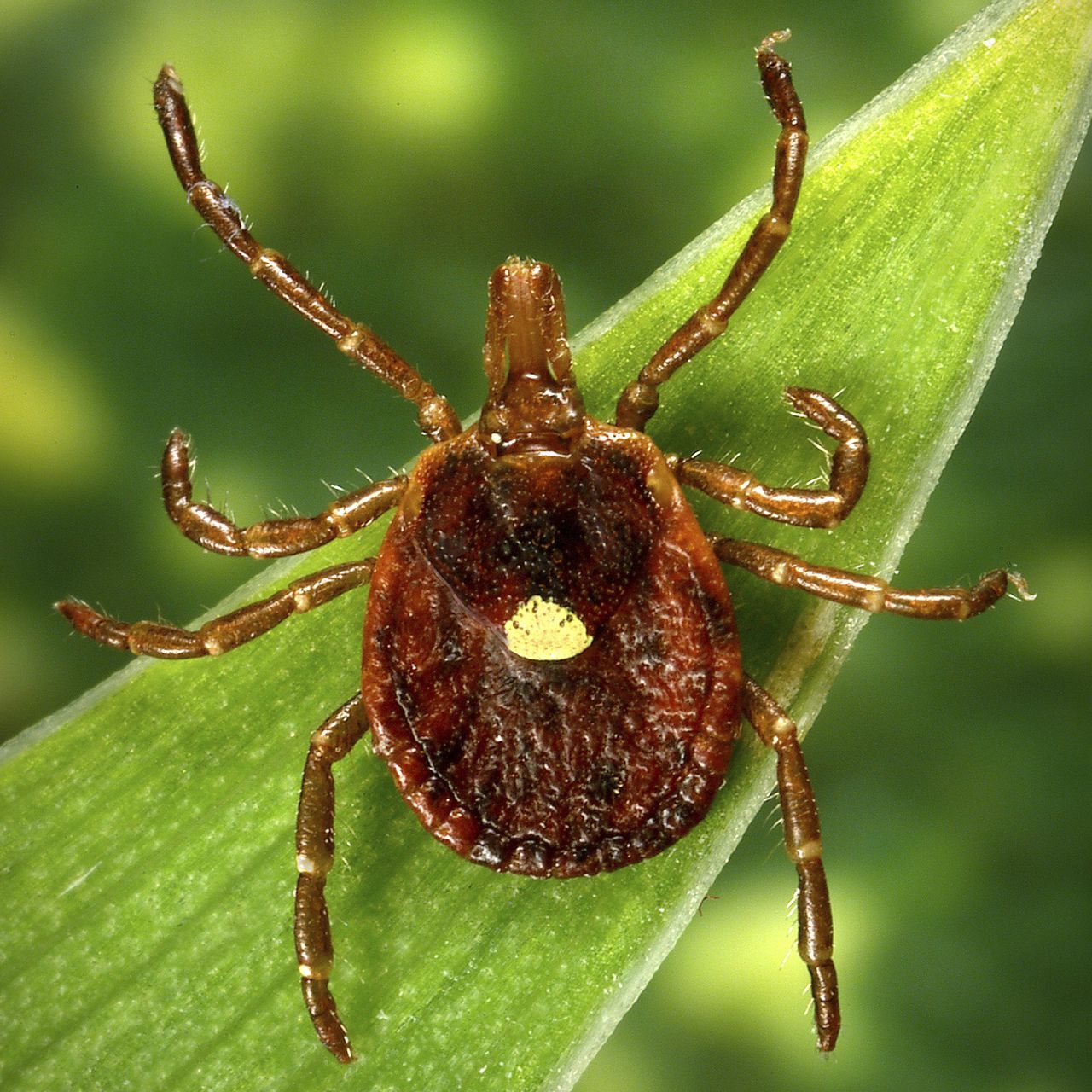 What are AGS symptoms? Tick bite syndrome linked to red meat allergies