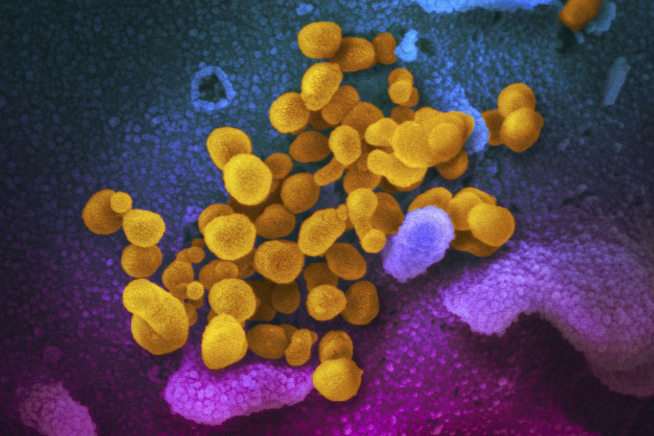 What should you do now if you test positive for COVID? How long should you quarantine?