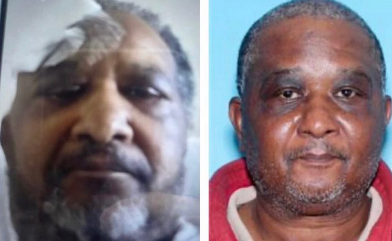 63-year-old man with head injury missing from Birmingham for 2 months