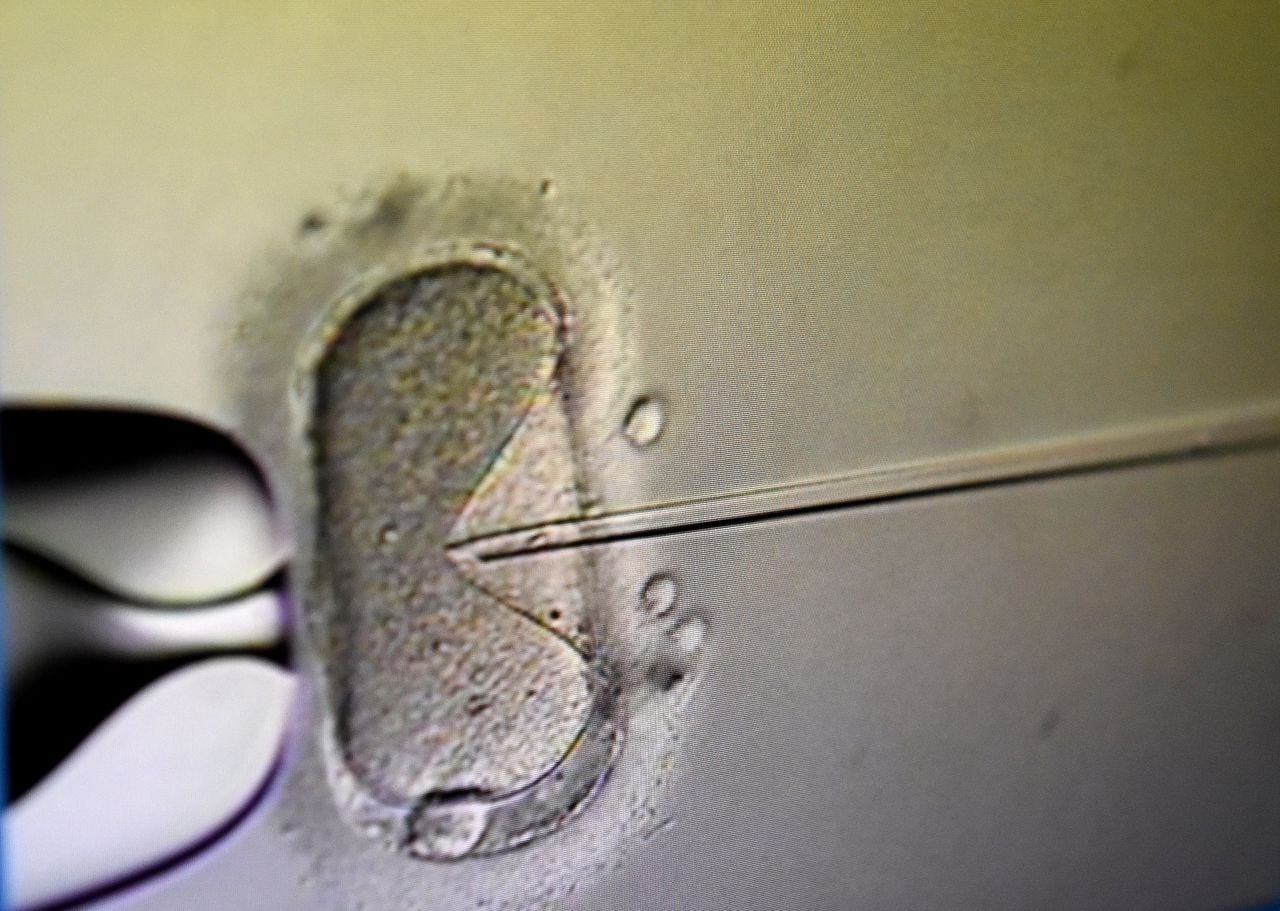 Alabama embryo ruling leads clinics to stop IVF treatments in Mobile, Homewood, Huntsville