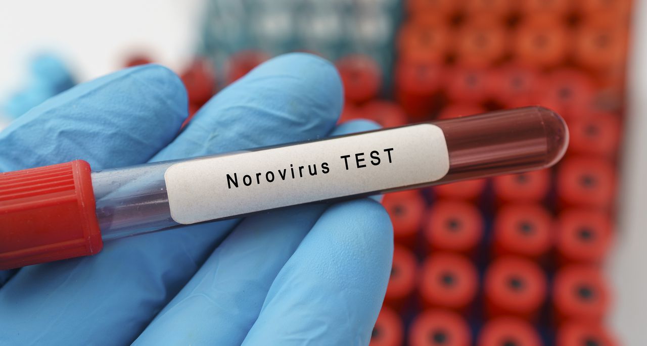 Norovirus is surging in the US: Symptoms, how it’s spread, where it’s spreading the fastest